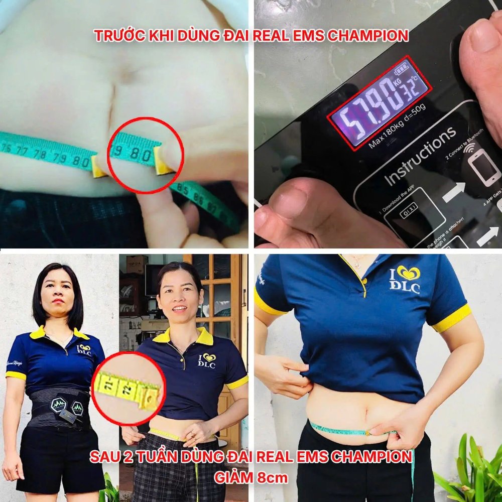 ĐAI ĐEO BỤNG CHAMPION BELT – REAL EMS